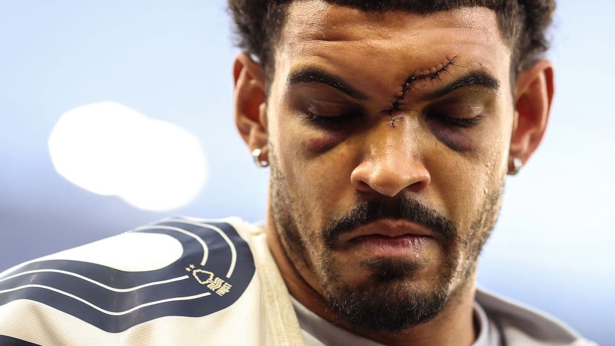 Player with facial injury and stitches on forehead